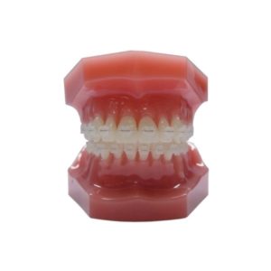 (10ct) Tooth Colored Stainless Steel (SS) Archwire, Natural